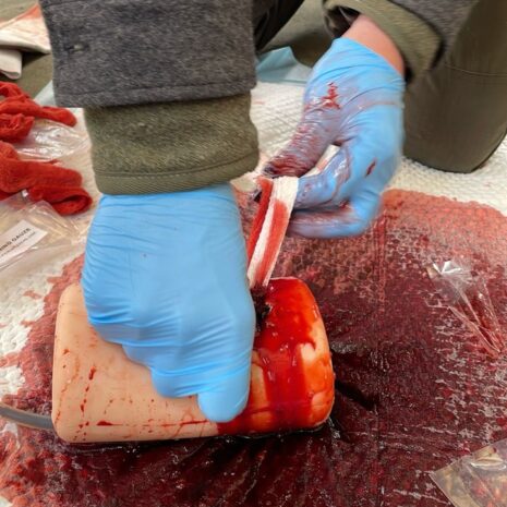 Haemorrhage 1 Haemorrhage 1